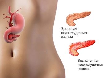 При больной поджелудочной можно ли есть сыр
